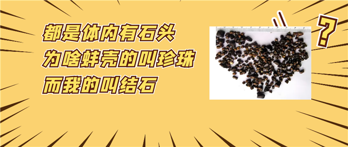胆结石只要不痛，就能“和平共处”？