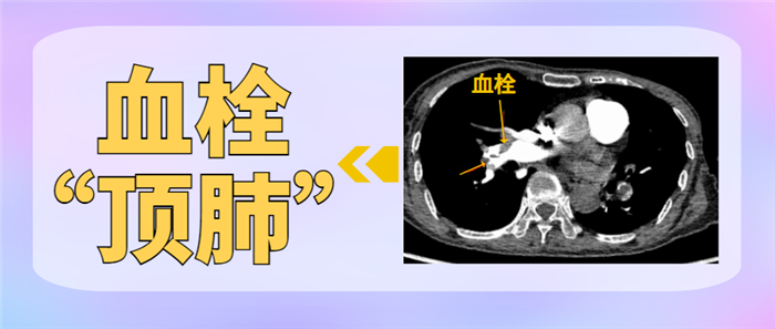 超凶险！你不能只知道心梗、脑梗，还有…