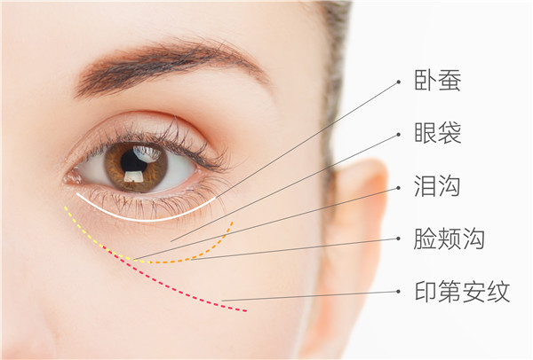 女明星也烦恼的猫咪纹，到底是怎么回事？