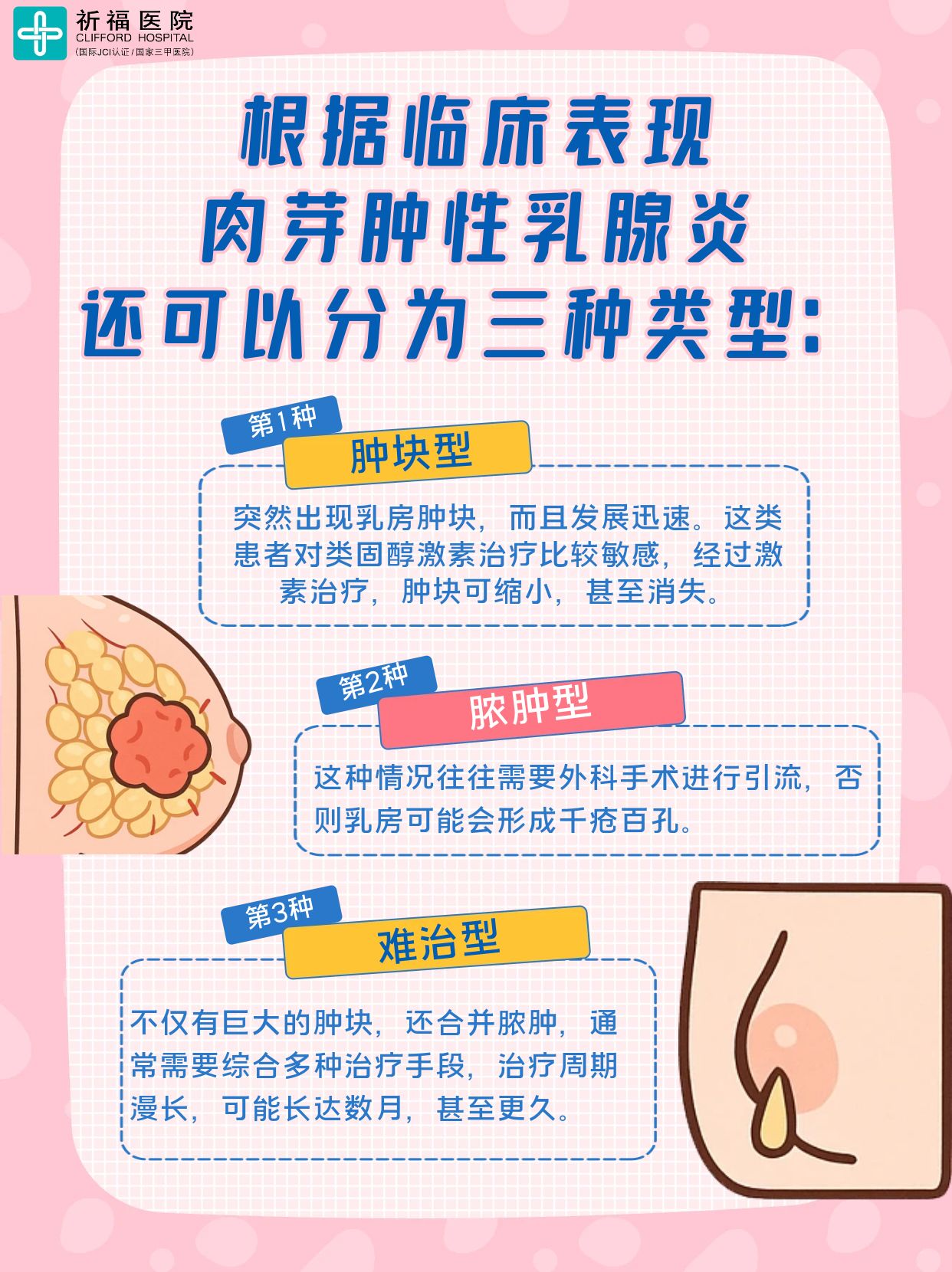 啥？非哺乳期乳腺也会发炎？90%的人都忽略了