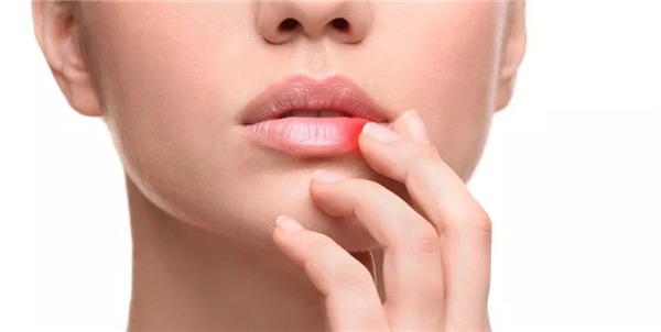 天气干燥过吐鲁番，润唇膏不离手也无济于事？当心是唇炎！