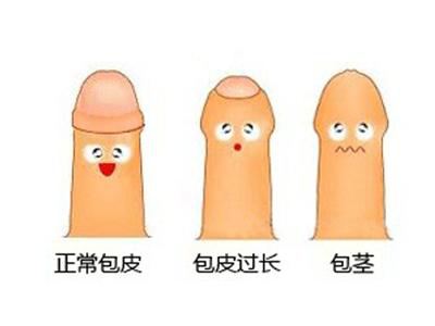 “你割了吗？”暑假小儿包皮手术火爆！专家：并非越早越好！