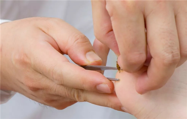 超厉害！祈福医院特聘专家成永明教授携“无痛蜂疗”走进央台《国医奇术》