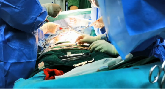 【新快报】健康 | 悬崖上走钢丝、气球上绣花，两项高难度心脏手术在番禺完成