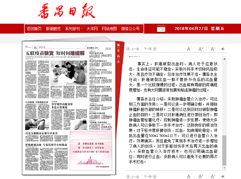 【番禺日报】 肝癌破裂出血 专家仅用半小时救命