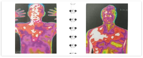 3分钟？这么快？这个检查婚前必做！但全广东只有两台机器！