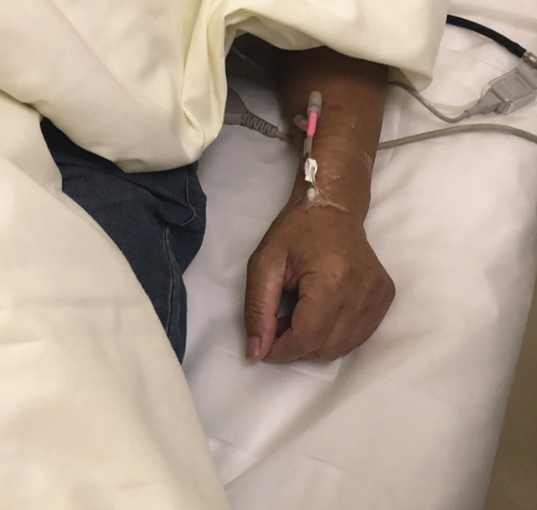 【羊城晚报】被这虫子叮咬至休克，再晚5分钟到医院就没救了！夏季高发！