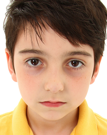 奇怪!2岁多宝宝为何长期“熊猫眼”？