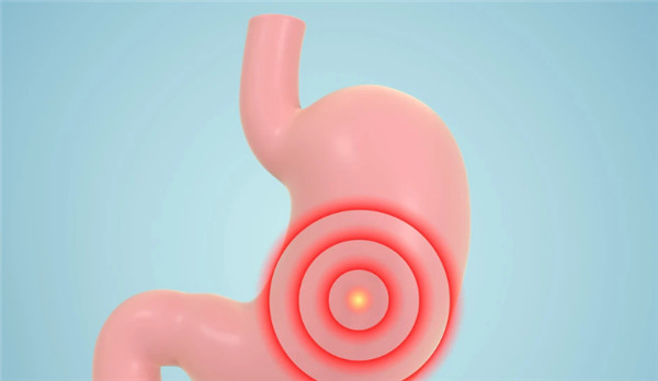 胃癌“元凶”被揪出，这些不良饮食习惯要注意！