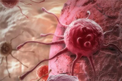 肝硬化的肝癌患者不能手术，该怎么办？