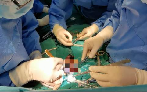 【人民日报】在“跳动的心脏”上手术：“悬崖走钢丝”和“气球上绣花”