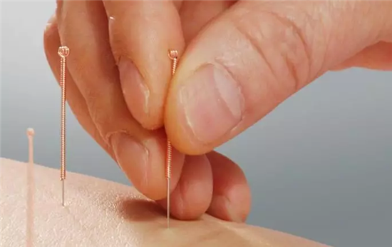 “脾气”差，百病生，针灸还能治“坏脾气”？