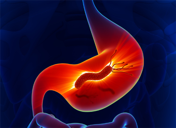 注意！共餐、接吻可传播幽门螺杆菌！如何预防、检测看这里