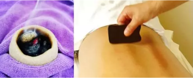 三伏天在肚脐上做个“热SPA”，疾病、亚健康统统走开！